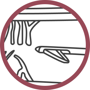 Illustration of Step 3 of Procedure